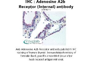 Image no. 2 for anti-Adenosine A2b Receptor (ADORA2B) (Internal Region) antibody (ABIN1731551)