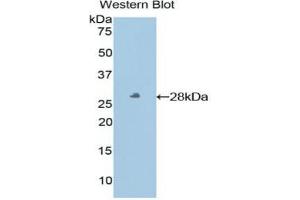 HLA-E antibody  (AA 22-358)