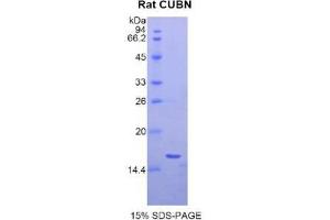 Image no. 1 for Cubilin (Intrinsic Factor-Cobalamin Receptor) (CUBN) (AA 3511-3623) protein (His tag) (ABIN1877551)