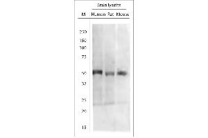 Image no. 5 for anti-Tyrosine Hydroxylase (TH) (AA 30-100) antibody (ABIN571649)