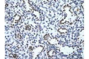 Image no. 1 for anti-PHD Finger Protein 17 (PHF17) (C-Term) antibody (ABIN2775971)