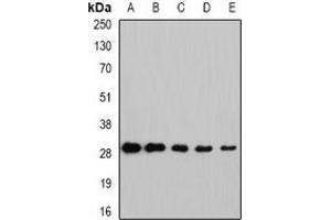 Image no. 2 for anti-Nicotinamide N-Methyltransferase (NNMT) antibody (ABIN2966847)