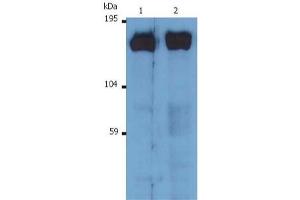 Image no. 1 for anti-Son of Sevenless Homolog 1 (SOS1) antibody (ABIN238504)