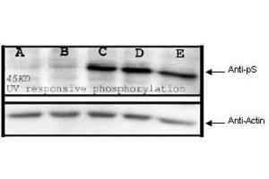 Affinity Purified anti-phosphoserine (pS) antibody is shown to detect phosphorylated proteins present in UV-treated mouse spleen cell lysates (top panel).