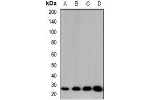 Image no. 3 for anti-Cell Death-Inducing DFFA-Like Effector B (CIDEB) antibody (ABIN3222861)