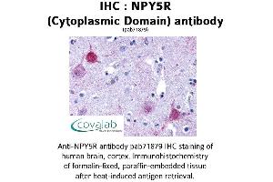 Image no. 1 for anti-Neuropeptide Y Receptor Y5 (NPY5R) (1st Cytoplasmic Domain) antibody (ABIN1737487)