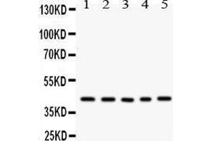 Image no. 1 for anti-Cysteine-Rich, Angiogenic Inducer, 61 (CYR61) (AA 54-381) antibody (ABIN3042351)