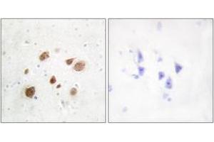 Image no. 2 for anti-Pregnancy Up-Regulated Non-Ubiquitously Expressed CaM Kinase (PNCK) (AA 161-210) antibody (ABIN1533961)