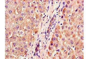 ACOX1 anticorps  (AA 113-273)