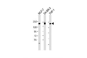 Image no. 4 for anti-Phosphatidylinositol-3,4,5-Trisphosphate-Dependent Rac Exchange Factor 1 (PREX1) (AA 1134-1163), (C-Term) antibody (ABIN656506)