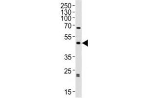 anti-Abhydrolase Domain Containing 12 (ABHD12) (AA 40-66) antibody
