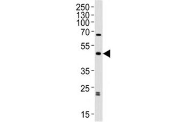 anti-Abhydrolase Domain Containing 12 (ABHD12) (AA 40-66) antibody