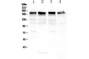 Image no. 1 for anti-Laminin, gamma 1 (LAMC1) (all Isoforms) antibody (ABIN5692889)