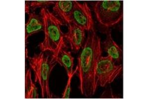 Image no. 3 for anti-PC4 and SFRS1 Interacting Protein 1 (PSIP1) antibody (ABIN1108769)