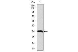 anti-Apolipoprotein A (APOA) antibody