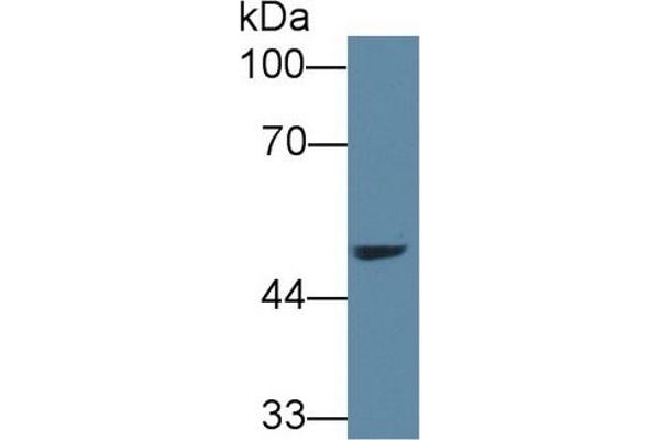 AGXT2 Antikörper  (AA 259-514)