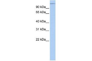 Image no. 1 for anti-Microtubule Associated Tumor Suppressor 1 (MTUS1) (Middle Region) antibody (ABIN635602)