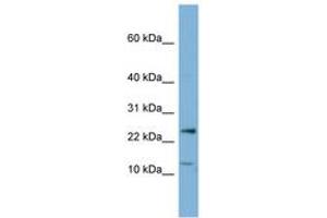 Image no. 1 for anti-Protein Phosphatase 1, Regulatory (Inhibitor) Subunit 11 (PPP1R11) (N-Term) antibody (ABIN6741758)