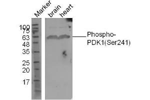 Image no. 5 for anti-3-phosphoinositide Dependent Protein Kinase-1 (PDPK1) (pSer241) antibody (ABIN744668)