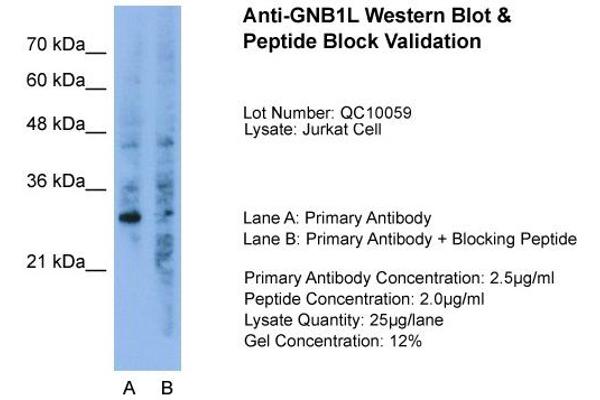 anti-Guanine Nucleotide Binding Protein (G Protein), beta Polypeptide 1-Like (GNB1L) (C-Term) antibody