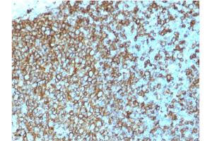 Image no. 3 for anti-MHC Class II HLA-DP/DQ/DR (HLA-DP/DQ/DR) antibody (ABIN6941388)