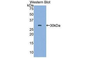Image no. 1 for anti-Plastin 3 (PLS3) (AA 234-475) antibody (ABIN1860267)