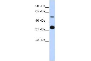 Image no. 1 for anti-Growth Differentiation Factor 2 (GDF2) (Middle Region) antibody (ABIN634786)