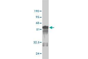 Image no. 4 for anti-Methyl-CpG Binding Domain Protein 5 (MBD5) (AA 1-229) antibody (ABIN565923)