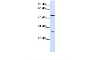 Image no. 1 for anti-Transmembrane Protein 127 (TMEM127) (AA 110-159) antibody (ABIN6738338)
