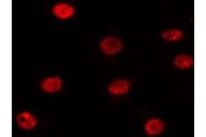 Image no. 1 for anti-SIX Homeobox 1 (SIX1) (Internal Region) antibody (ABIN6259572)