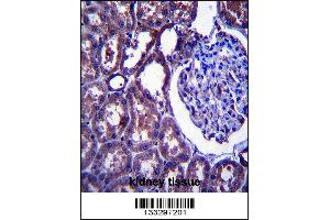 Image no. 2 for anti-Niemann-Pick Disease, Type C1 (NPC1) (Center) antibody (ABIN2447143)