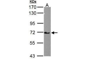 Image no. 1 for anti-Calcium Channel, Voltage-Dependent, beta 4 Subunit (CACNB4) (C-Term) antibody (ABIN2854649)