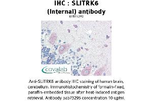 Image no. 1 for anti-SLIT and NTRK-Like Family, Member 6 (SLITRK6) (Internal Region) antibody (ABIN1739444)