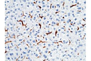 Image no. 2 for anti-Fc Receptor, IgG, High Affinity I (FCGR1) (AA 1-297), (Extracellular Domain) antibody (ABIN2000303)