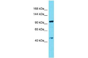 Image no. 1 for anti-Coiled-Coil Domain Containing 135 (CCDC135) (C-Term) antibody (ABIN2790974)