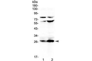 Image no. 1 for anti-Complement Factor D (CFD) (AA 26-263) antibody (ABIN5708190)