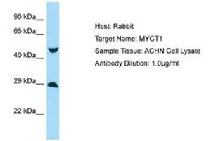 Image no. 1 for anti-Myc Target 1 (MYCT1) (AA 95-144) antibody (ABIN6750014)