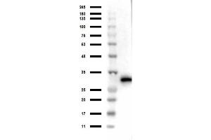 Image no. 9 for anti-Red Fluorescent Protein (RFP) antibody (ABIN129578)