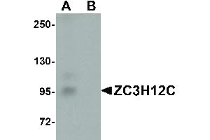 Image no. 1 for anti-Zinc Finger CCCH-Type Containing 12C (ZC3H12C) (N-Term) antibody (ABIN6656904)