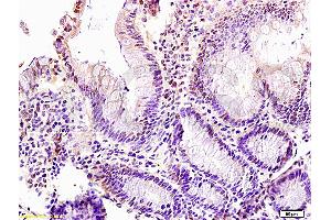 LZTFL1 antibody  (AA 101-200)