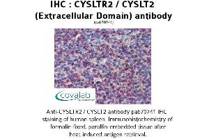 CasLTR2 antibody  (2nd Extracellular Domain)