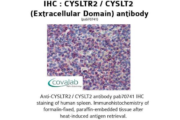 CasLTR2 Antikörper  (2nd Extracellular Domain)