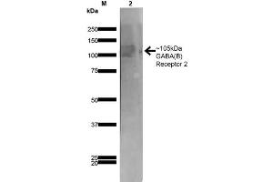 Image no. 2 for anti-gamma-aminobutyric Acid (GABA) B Receptor, 2 (GABBR2) (AA 861-912) antibody (ABIN1686619)