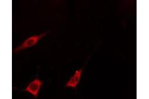 KCNA5 antibody  (Internal Region)