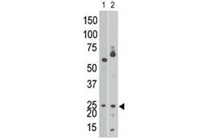 BNIP3 antibody  (AA 152-187)