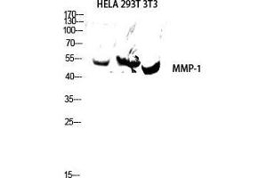 Image no. 2 for anti-Matrix Metallopeptidase 1 (Interstitial Collagenase) (MMP1) (C-Term) antibody (ABIN3185593)
