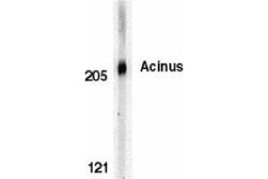 Image no. 3 for anti-Apoptotic Chromatin Condensation Inducer 1 (ACIN1) (C-Term) antibody (ABIN499199)