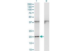 Western Blot analysis of FTL expression in transfected 293T cell line by FTL monoclonal antibody (M15), clone 1C14.