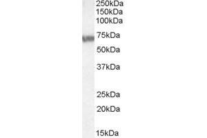 Image no. 2 for anti-ATP-Binding Cassette, Sub-Family D (Ald), Member 4 (ABCD4) (Internal Region) antibody (ABIN335110)