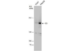 WB Image C3 antibody detects C3 protein by western blot analysis.